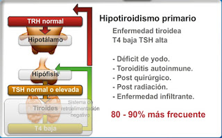 hipotiroidismo primario