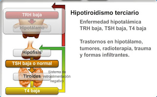 hipotiroidismo terciario