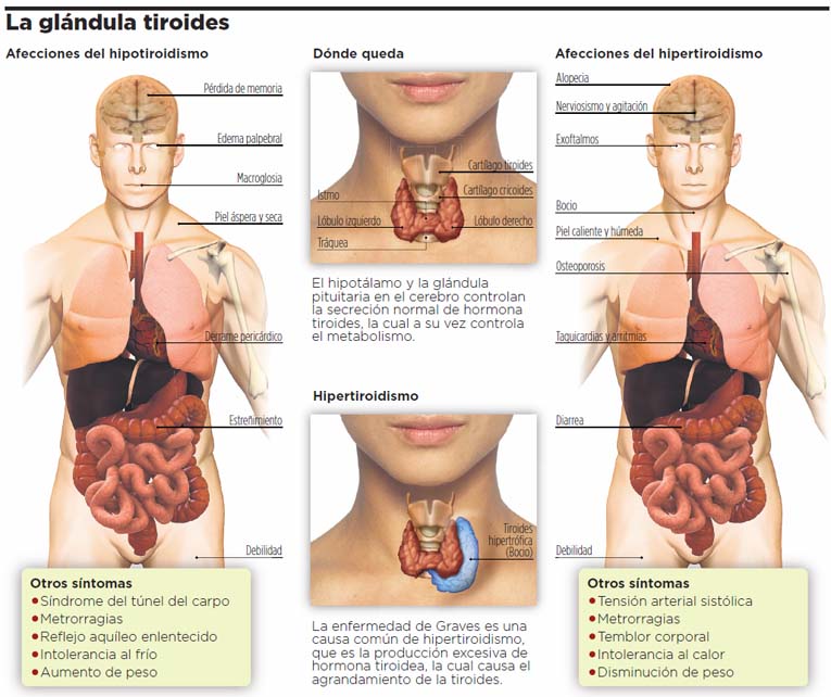 glandula tiroides sintomas 